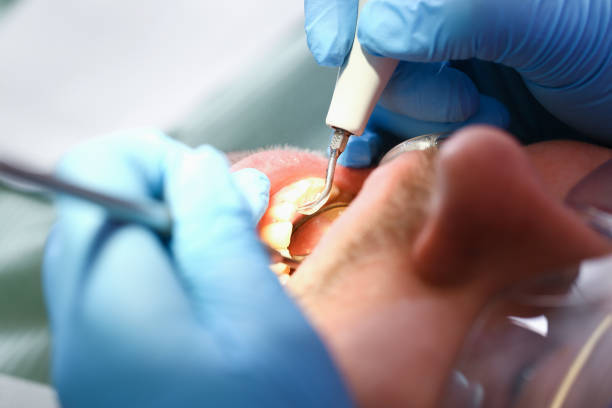 Best Emergency Dental Extractions in Pocahontas, AR