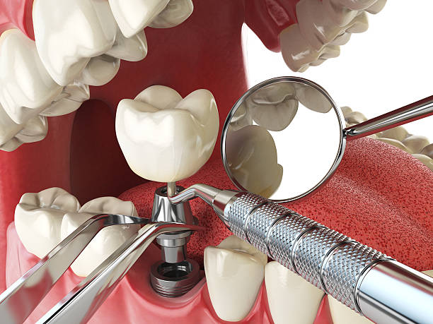 Fast & Reliable Emergency Dental Services in AR